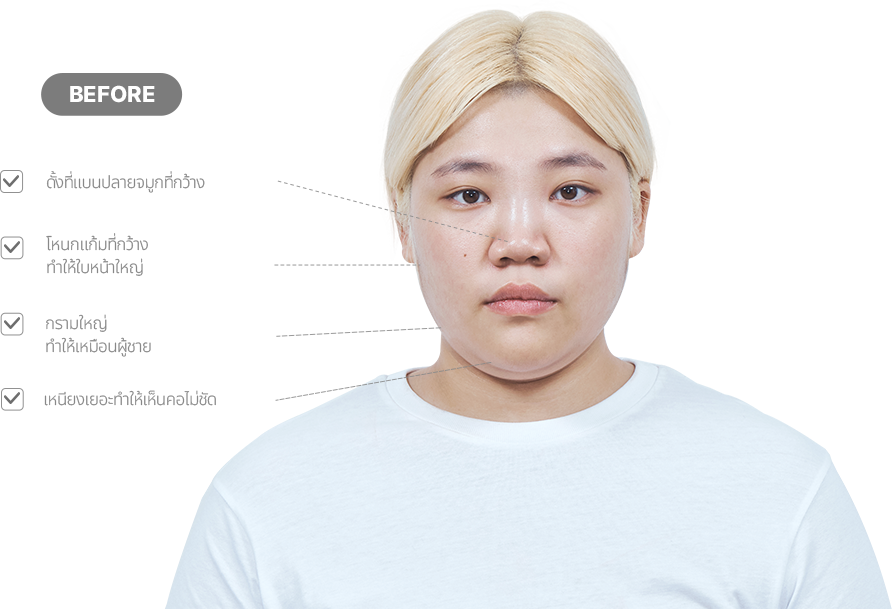 맥미걸 악플콜렉터 얼굴 수술 전 문제점과 개선점