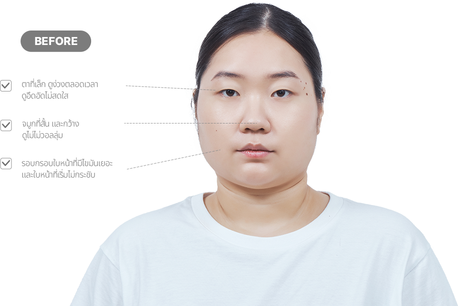 맥미걸 악플콜렉터 얼굴 수술 전 문제점과 개선점