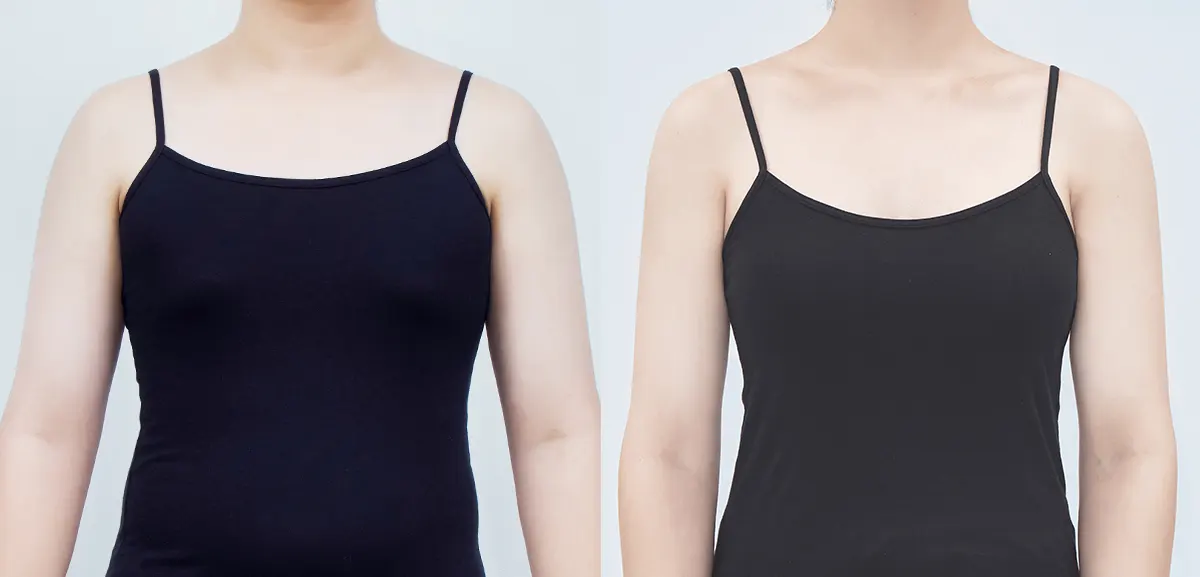 Before and After Surgery