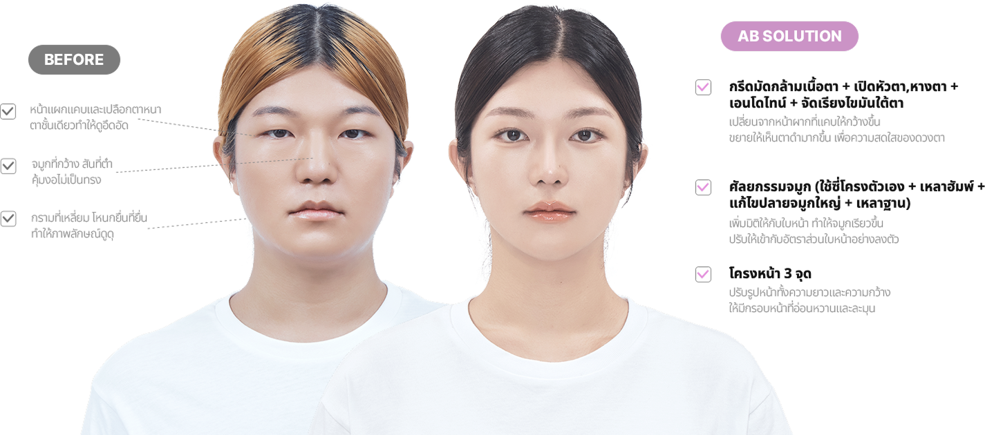 맥미걸 악플콜렉터 얼굴 수술 전 문제점과 개선점