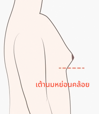 surgery_illust