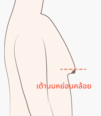 surgery_illust