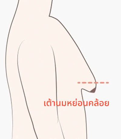 surgery_illust