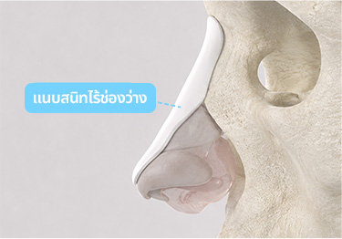 ศัลยกรรมจมูก 3D SOFIT