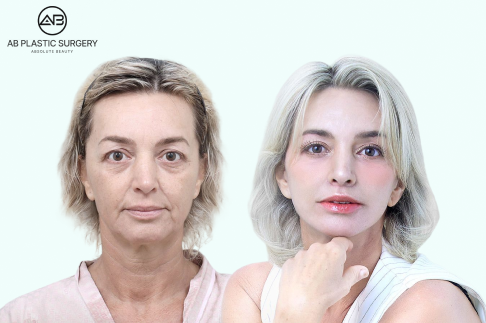 AB Plastic Surgery
