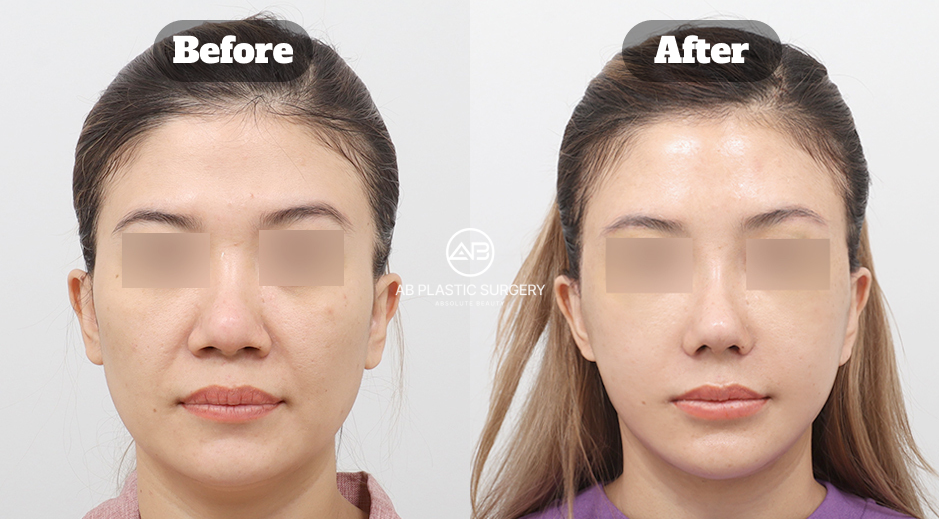 การรักษาด้วยสเต็มเซลล์คาดว่าจะได้รับความสนใจมากขึ้นในปี 2026