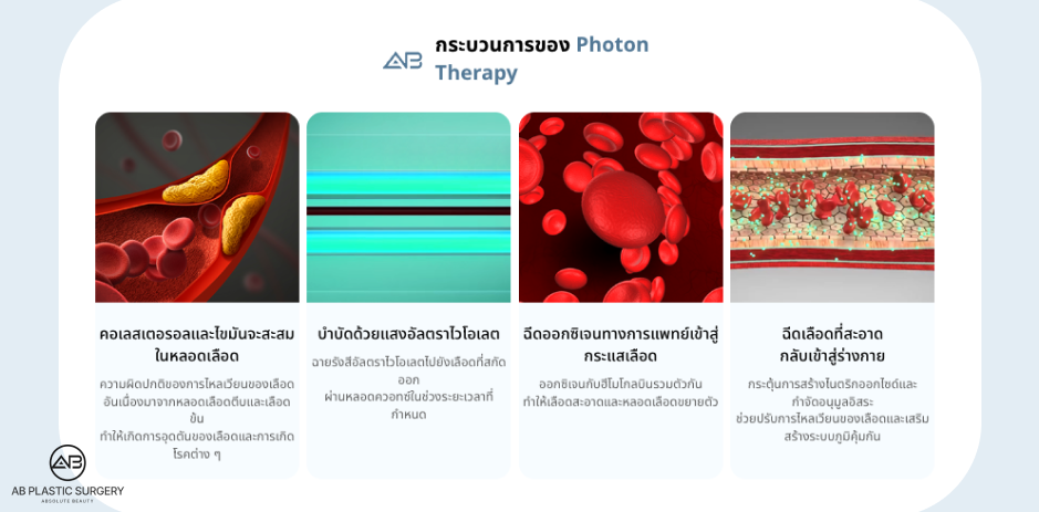 เทคโนโลยีสเต็มเซลล์และ Photon Therapy ของโรงพยาบาลศัลยกรรมAB เป็นการรักษาฟื้นฟูที่โดดเด่นในการทำความสะอาดเลือดและเสริมการทำงานของหลอดเลือด
