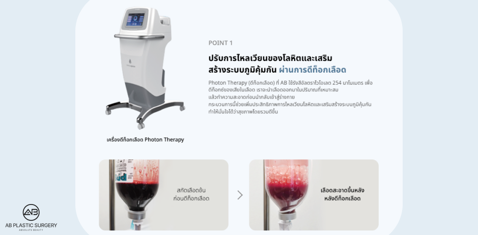 กระบวนการทำความสะอาดเลือดและเสริมภูมิคุ้มกันด้วย Photon Therapy ของโรงพยาบาลศัลยกรรมAB