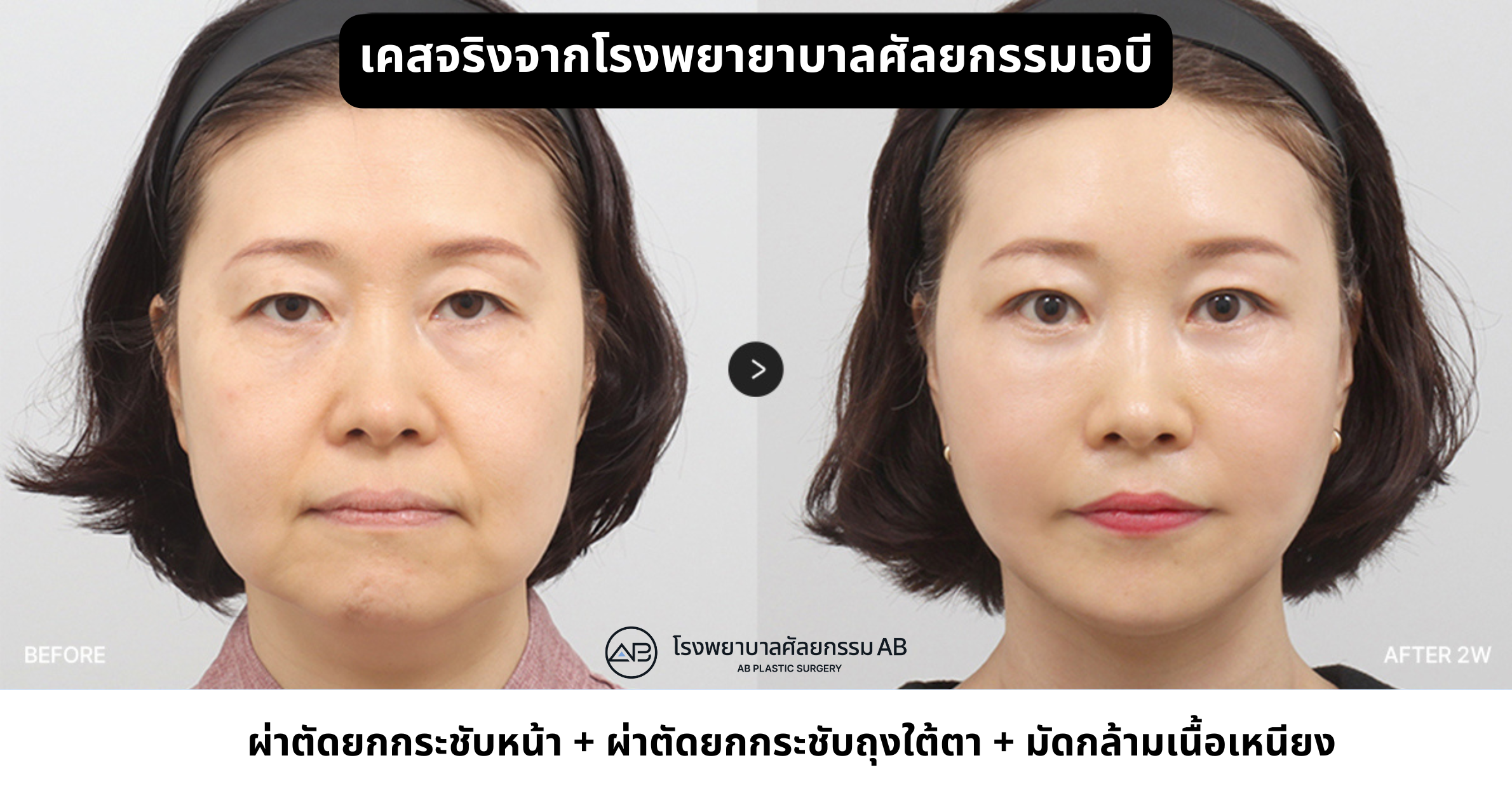AB Plastic Surgery