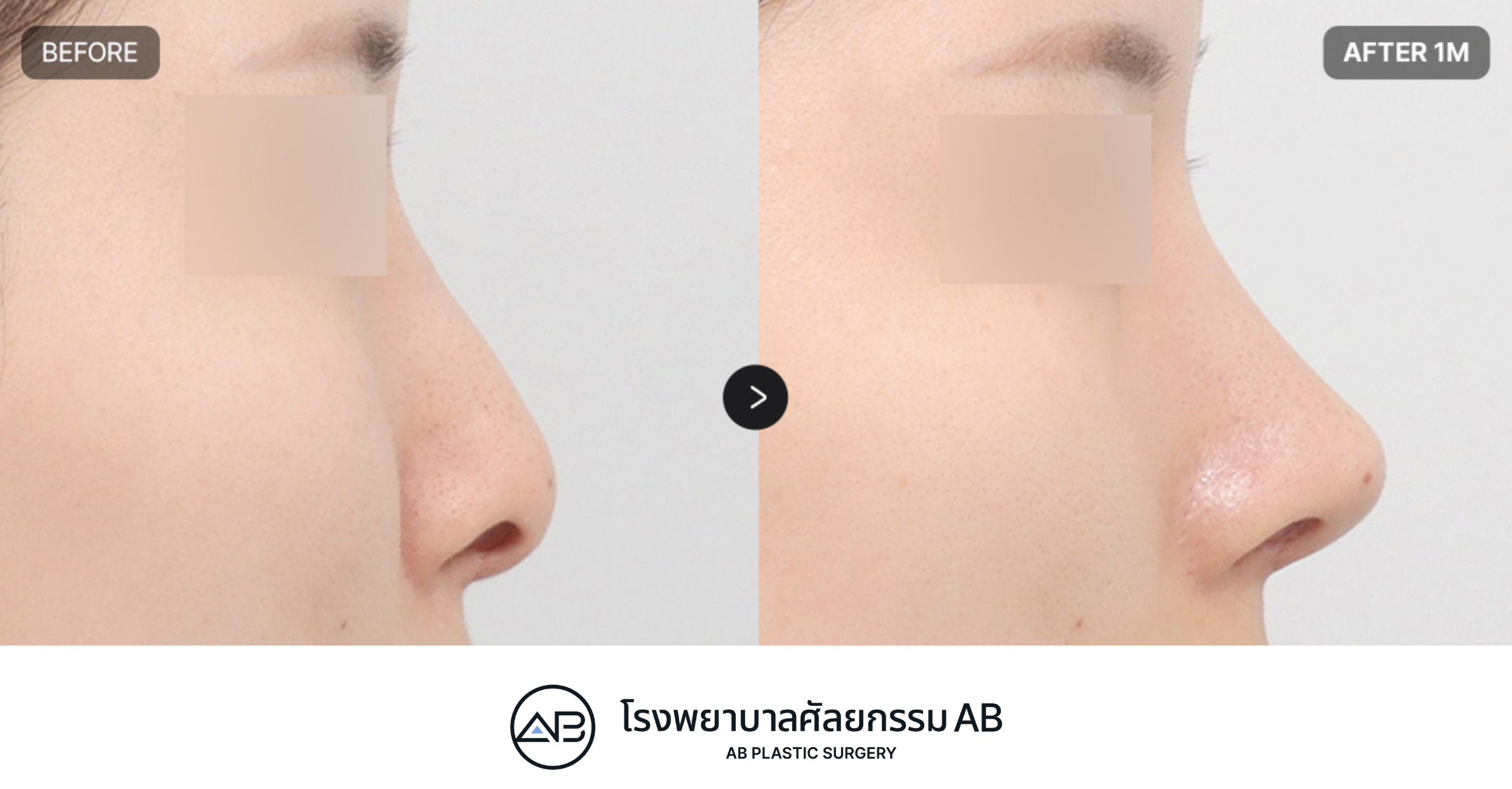 AB Plastic Surgery
