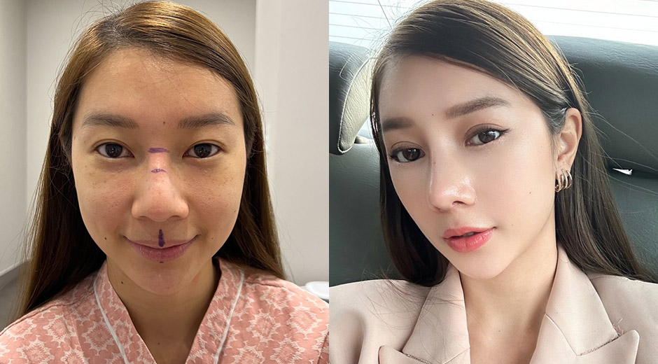 AB Plastic Surgery